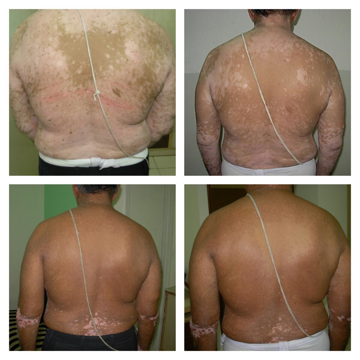 Continuing Ahmedabad pearls