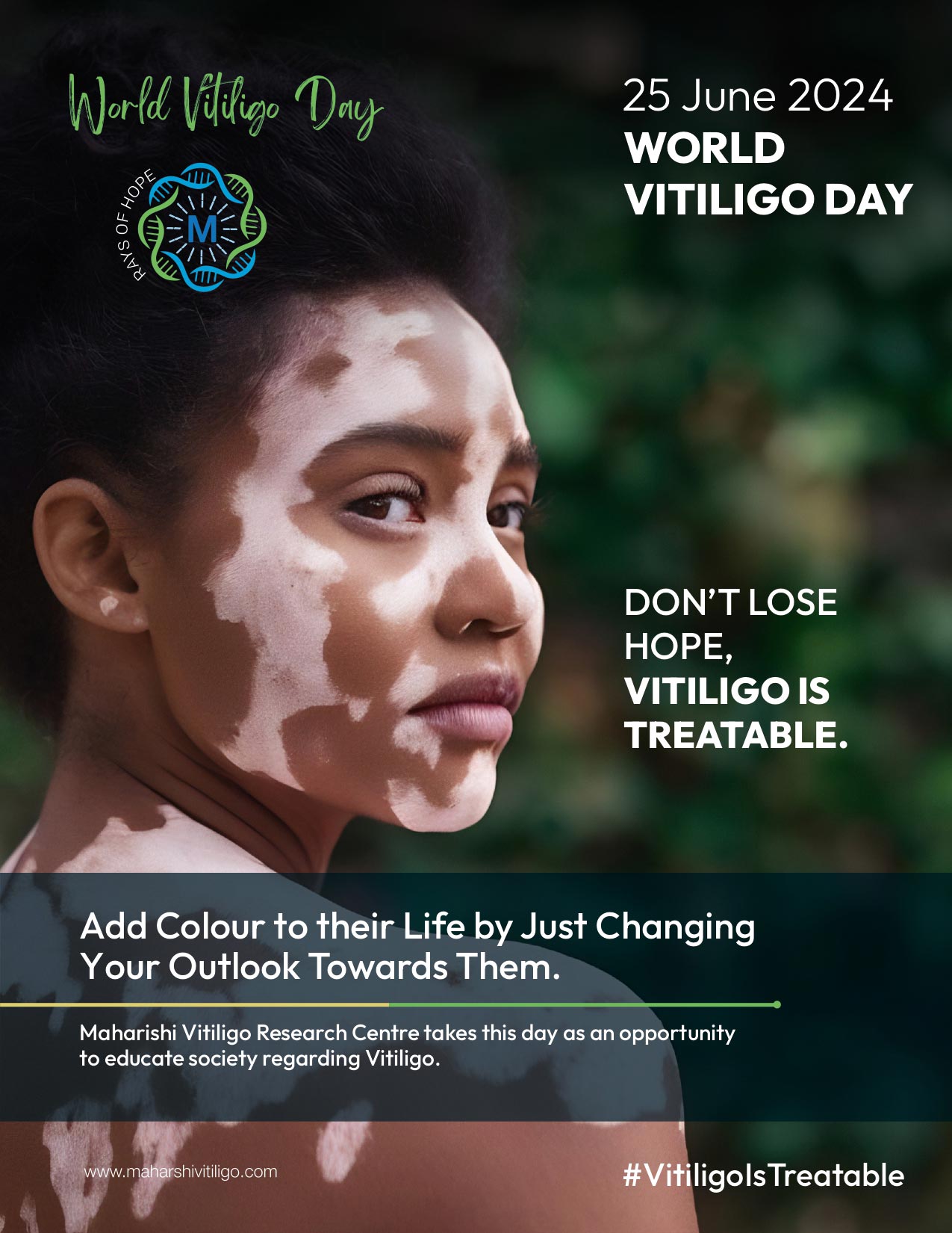 Celebrating World Vitiligo Day 2024: Spreading Awareness and Empowerment